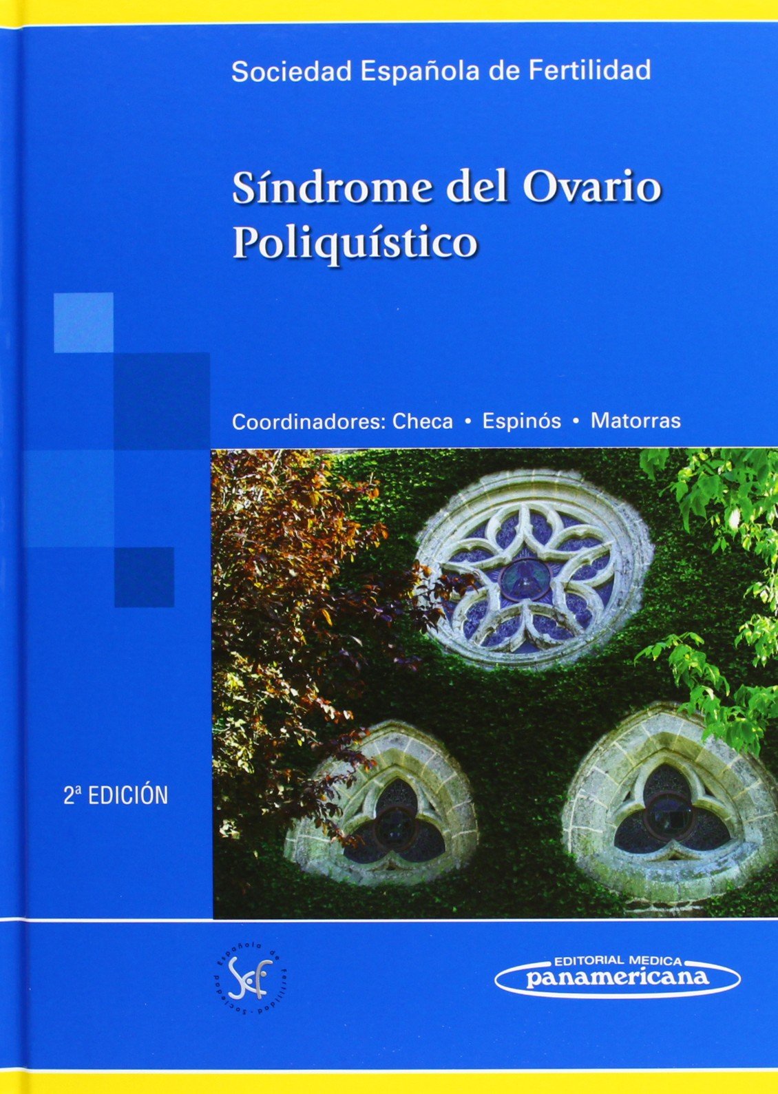 Síndrome del ovario poliquístico Medicine