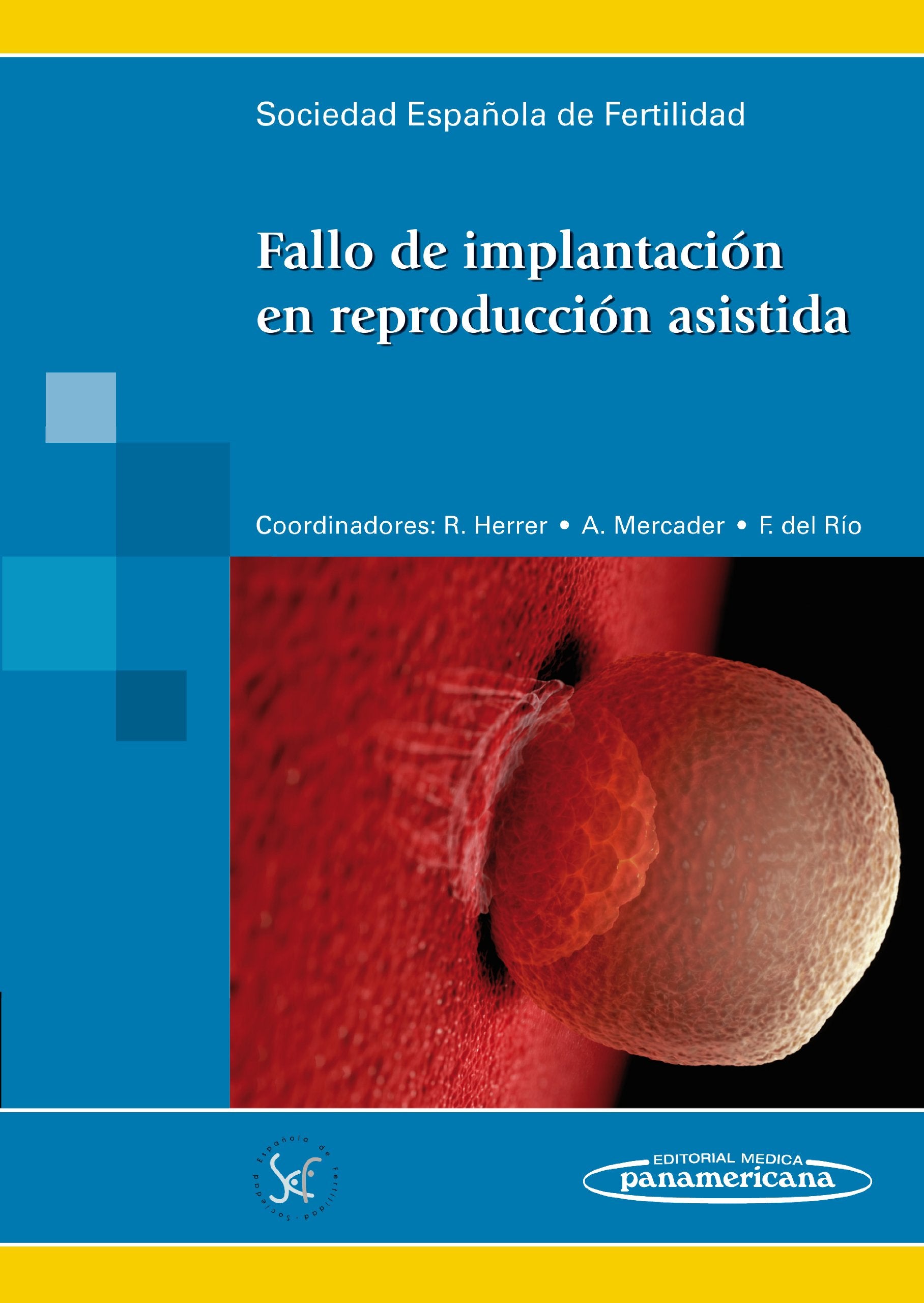 Sociedad Española en Reproducción Asistida: Fallo de implant Medicine
