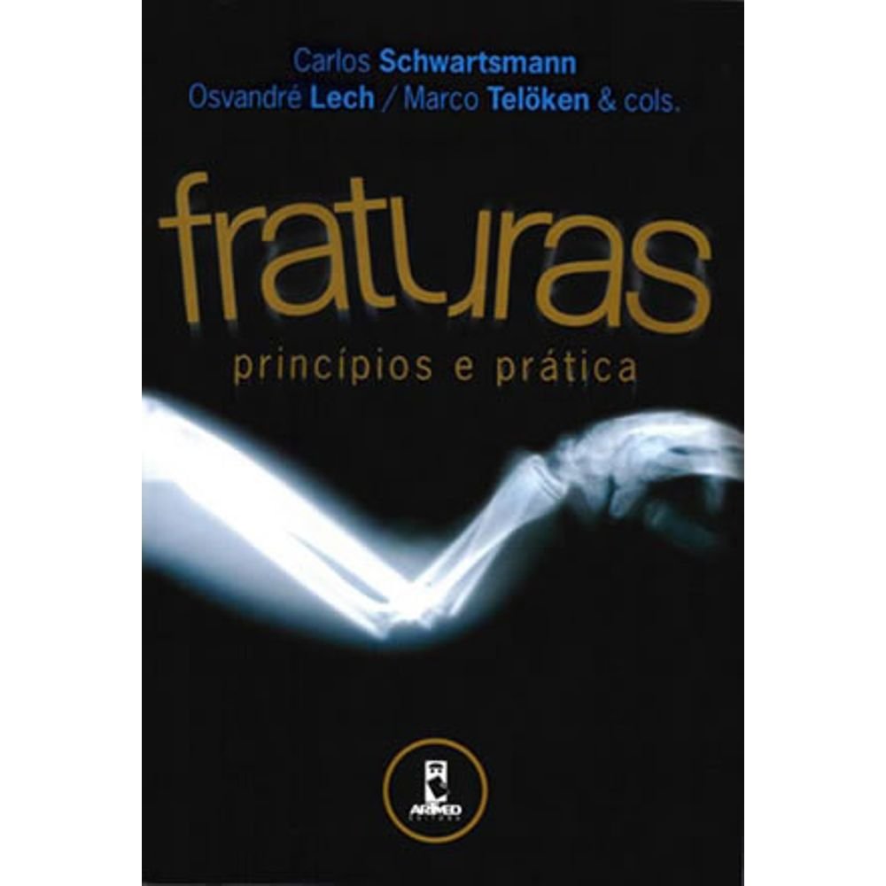 Fraturas. Principios E Prática (Em Portuguese do Brasil) Books