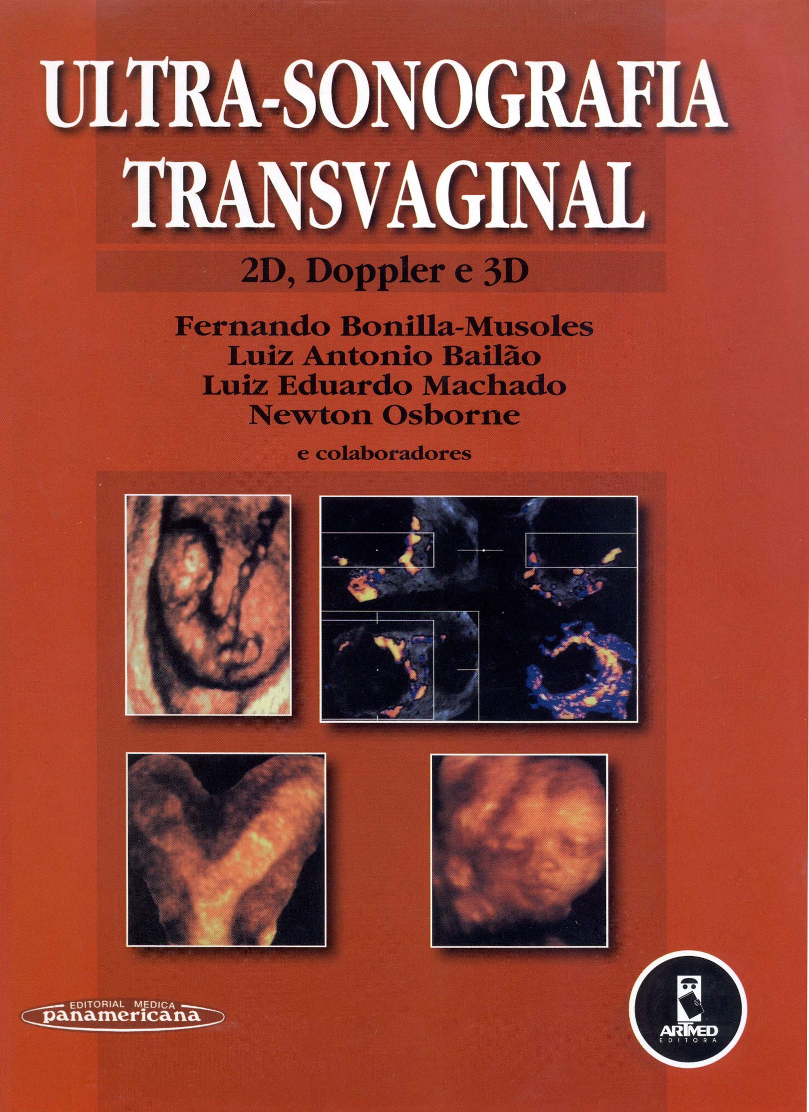 Ultra-Sonografia Transvaginal (Em Portuguese do Brasil) Books