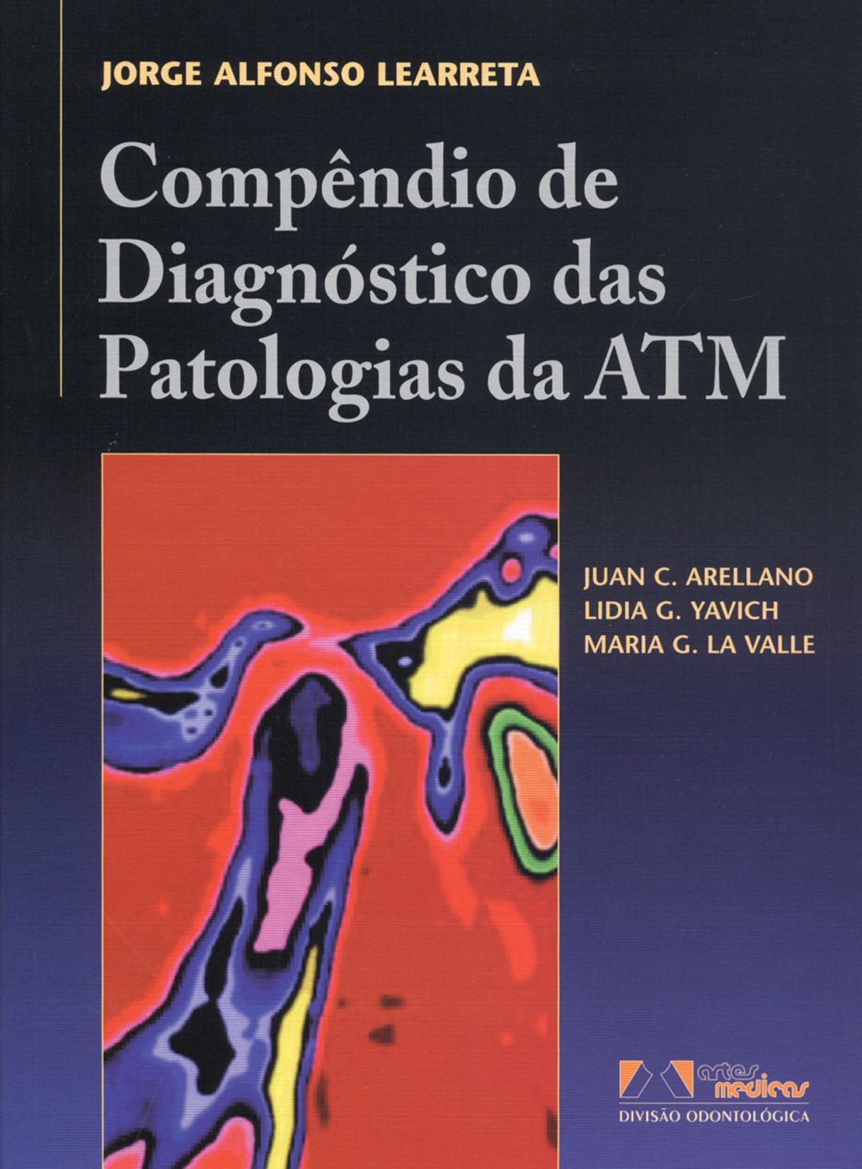 Compendio De Diagnostico Das Patologias Da ATM (Em Portuguese do Brasil) Books