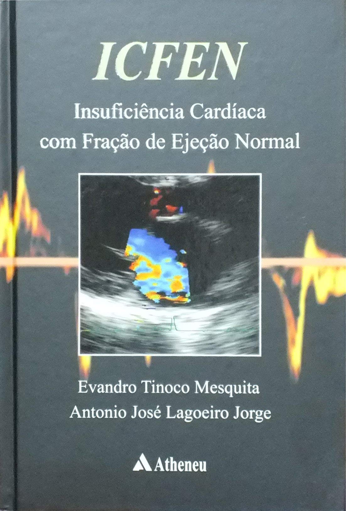 ICFEN. Insuficiencia Cardiaca Com Fraçao De Ejeçao Normal (Em Portuguese do Brasil) Books