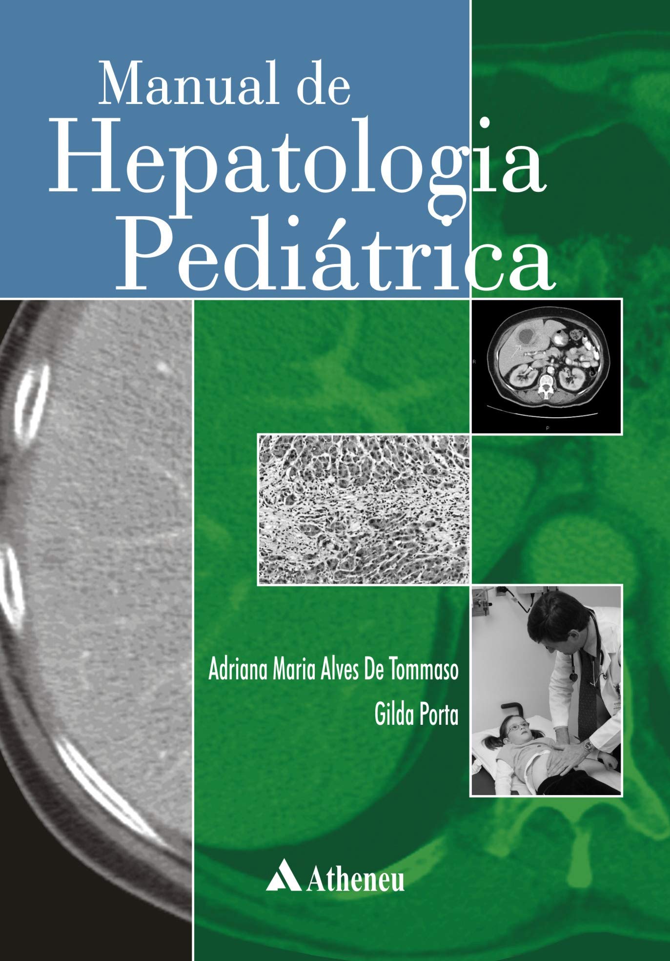 Manual De Hepatologia Pediatrica (Em Portuguese do Brasil) Books