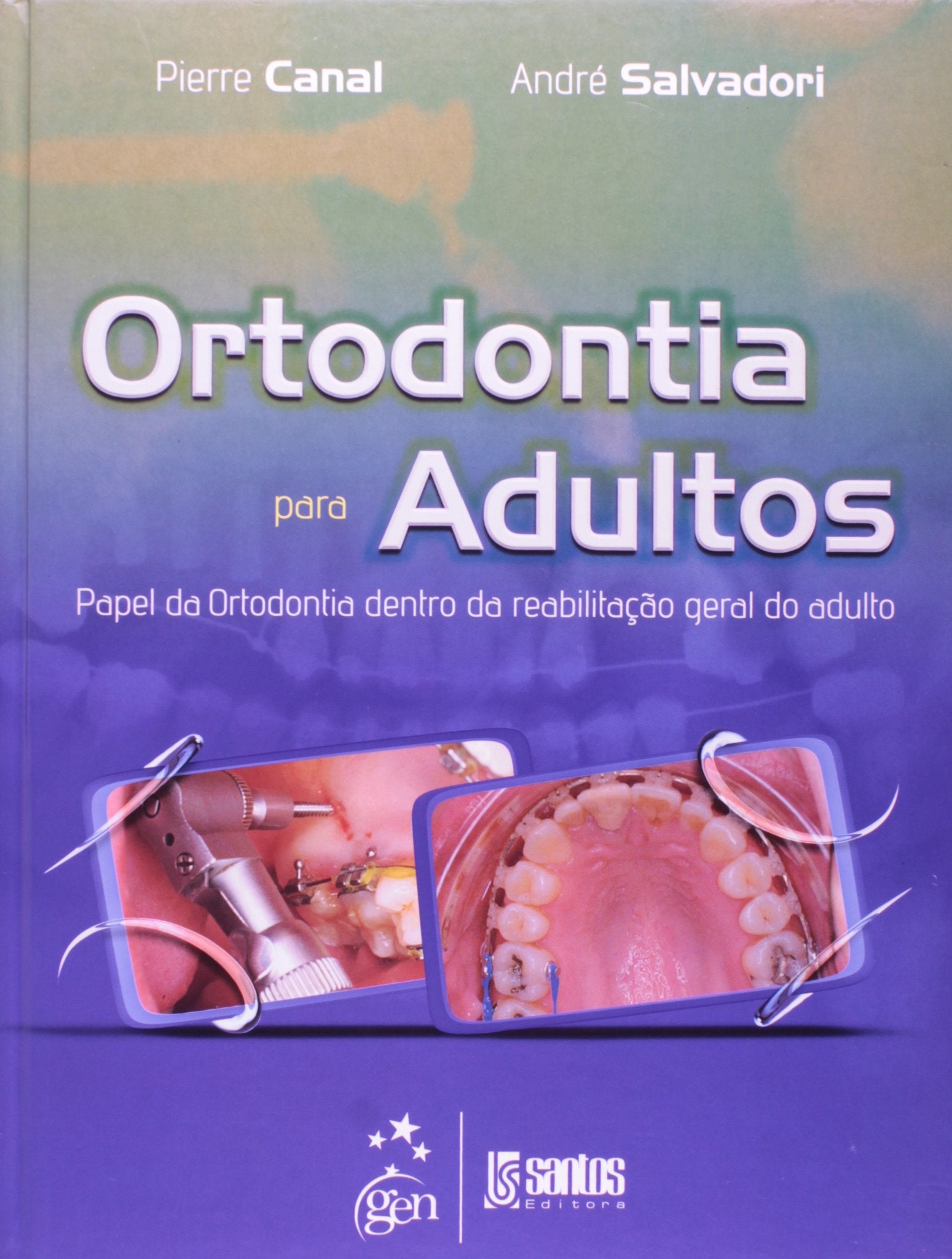 Ortodontia Para Adultos (Em Portuguese do Brasil) book
