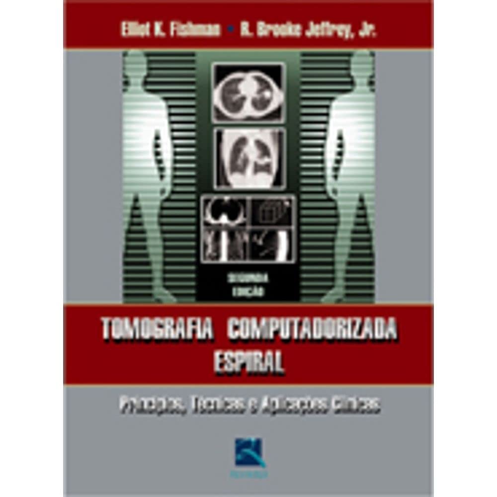 Tomografia Computadorizada Espiral. Principios Tecnicas E Aplicações Clinicas (Em Portuguese do Brasil) book