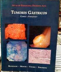 atlas de endoscopia digestiva alta tumores gastricos clinic Books