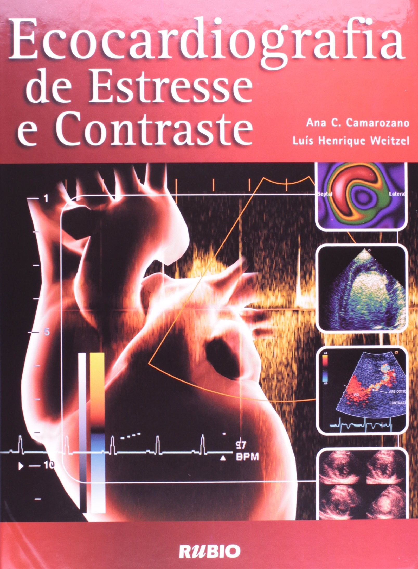 Ecocardiografia De Estresse E Contraste (Em Portuguese do Brasil) Books