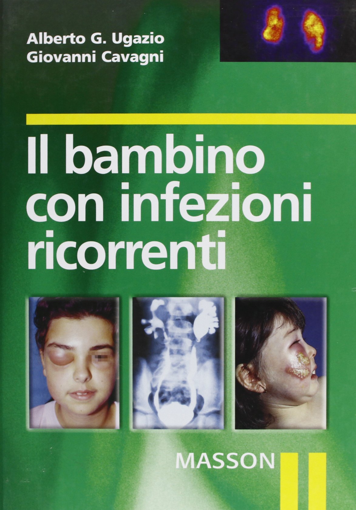 Il bambino con infezioni ricorrenti book