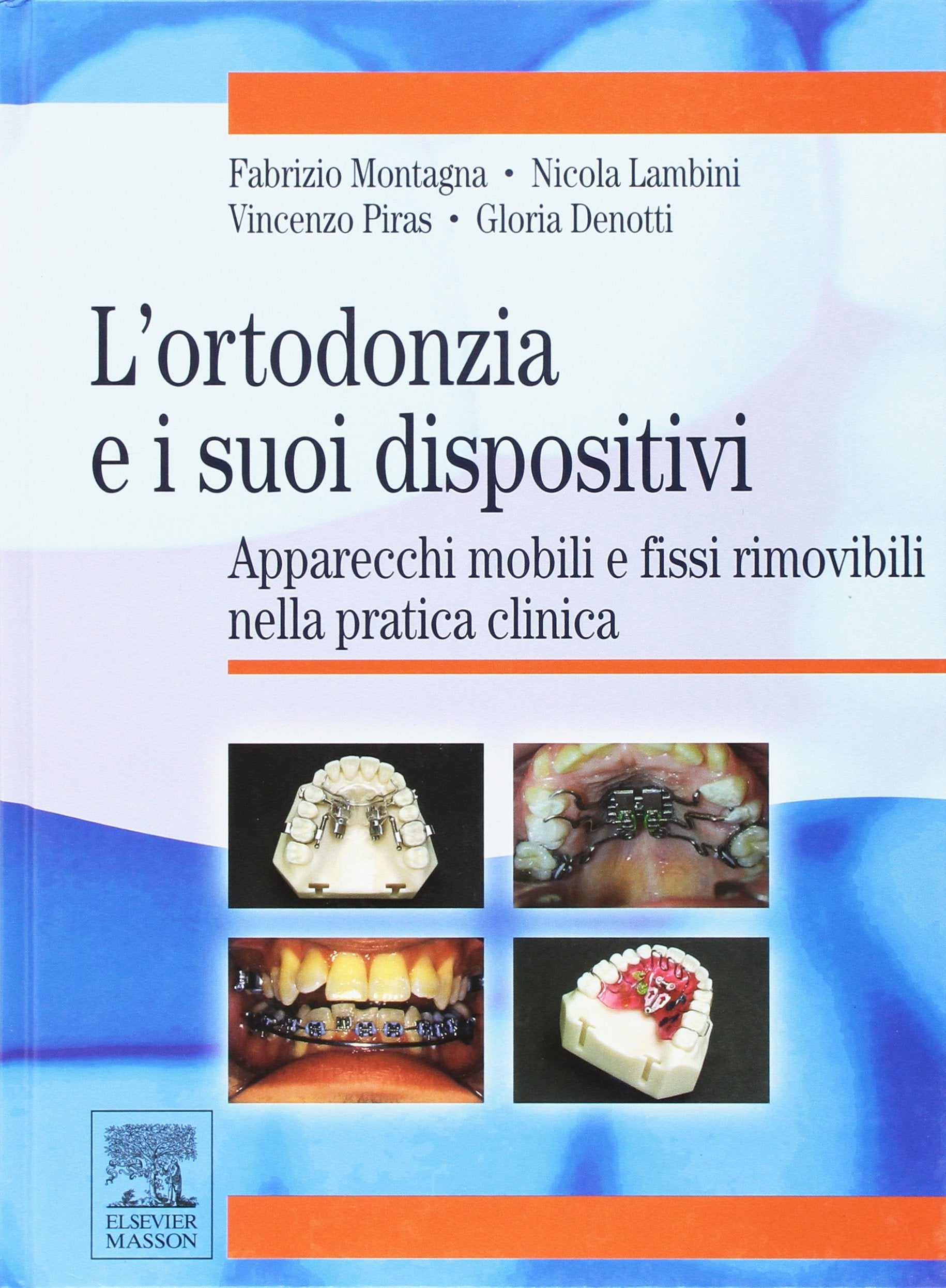 L'ortodonzia e suoi dispositivi. Apparecchi mobili e fissi rimovibili nella pratica clinica Medicine