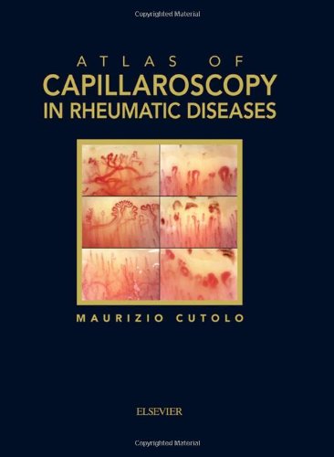 Atlas of capillaroscopy in rheumatic diseases book