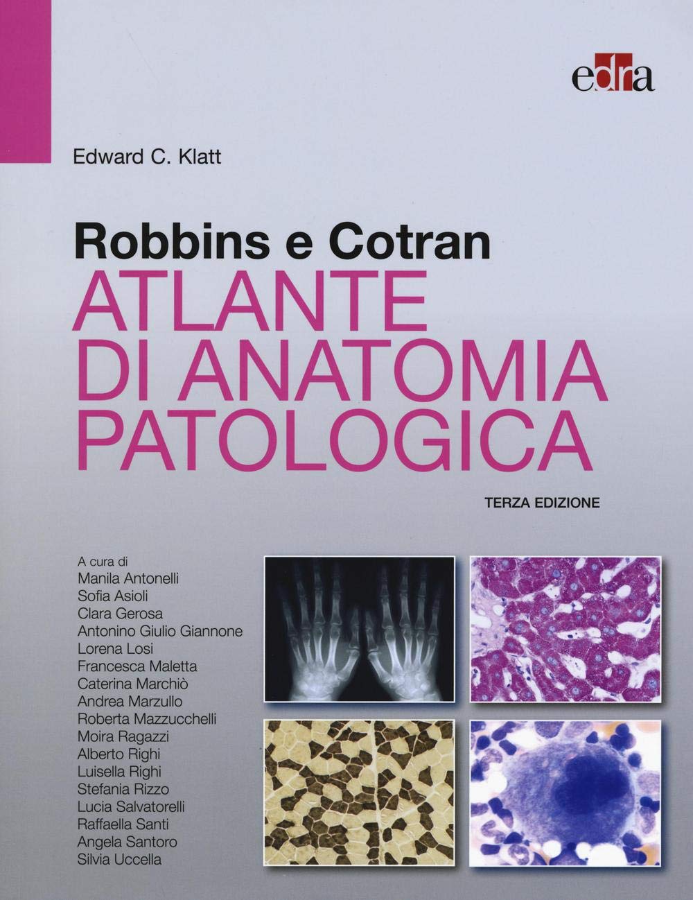 Robbins e Cotran. Atlante di anatomia patologica book