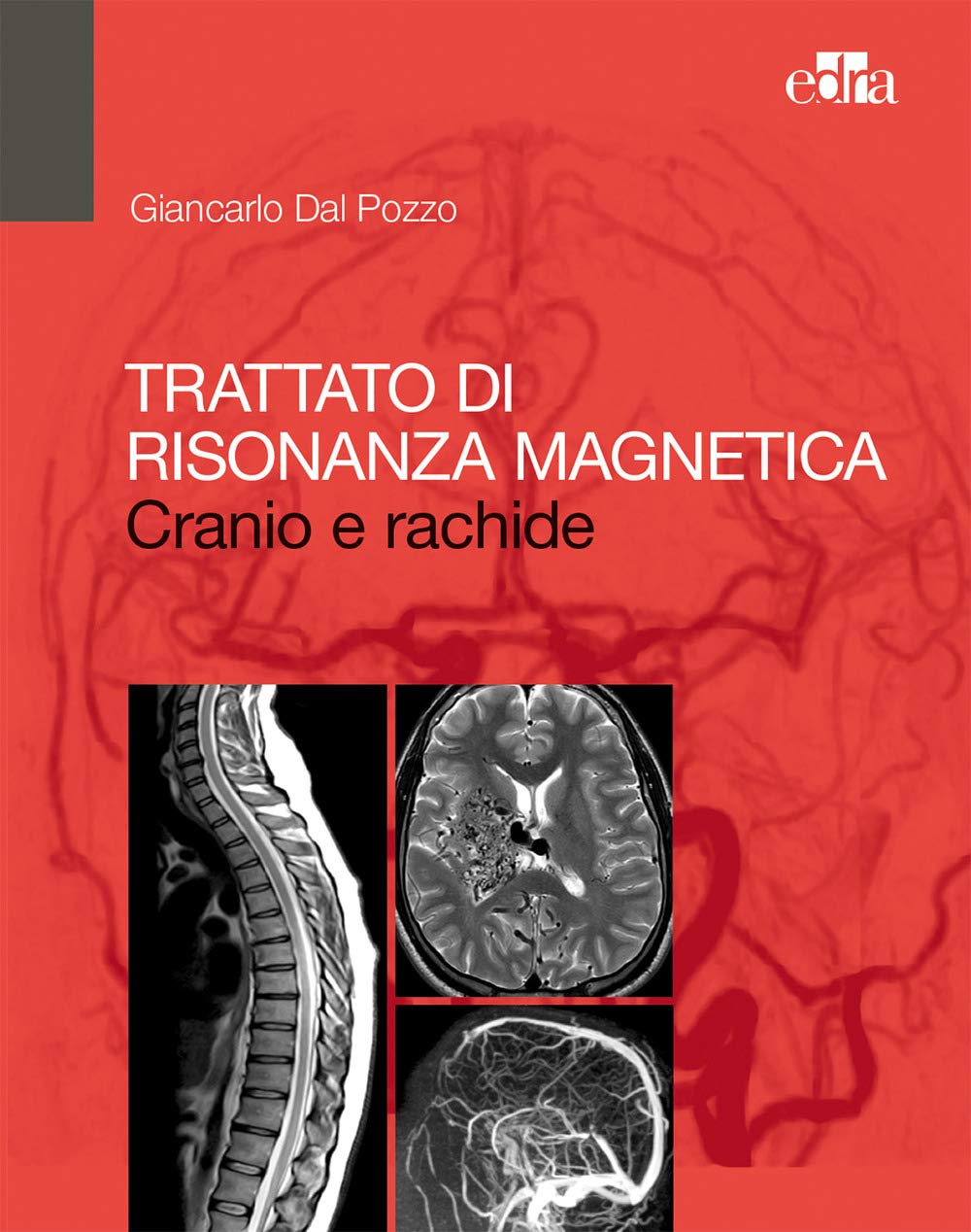 Trattato di risonanza magnetica. Cranio e rachide book