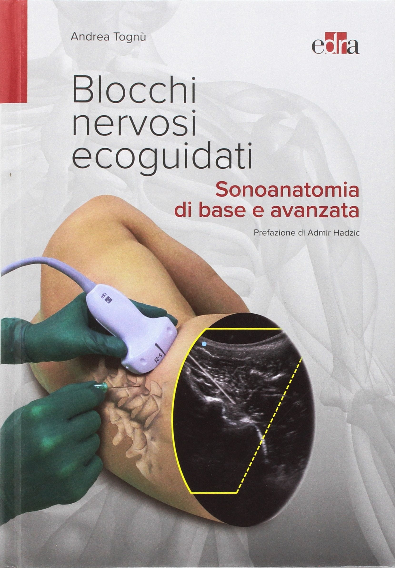 Blocchi nervosi ecoguidati. Sonoanatomia di base avanzata book