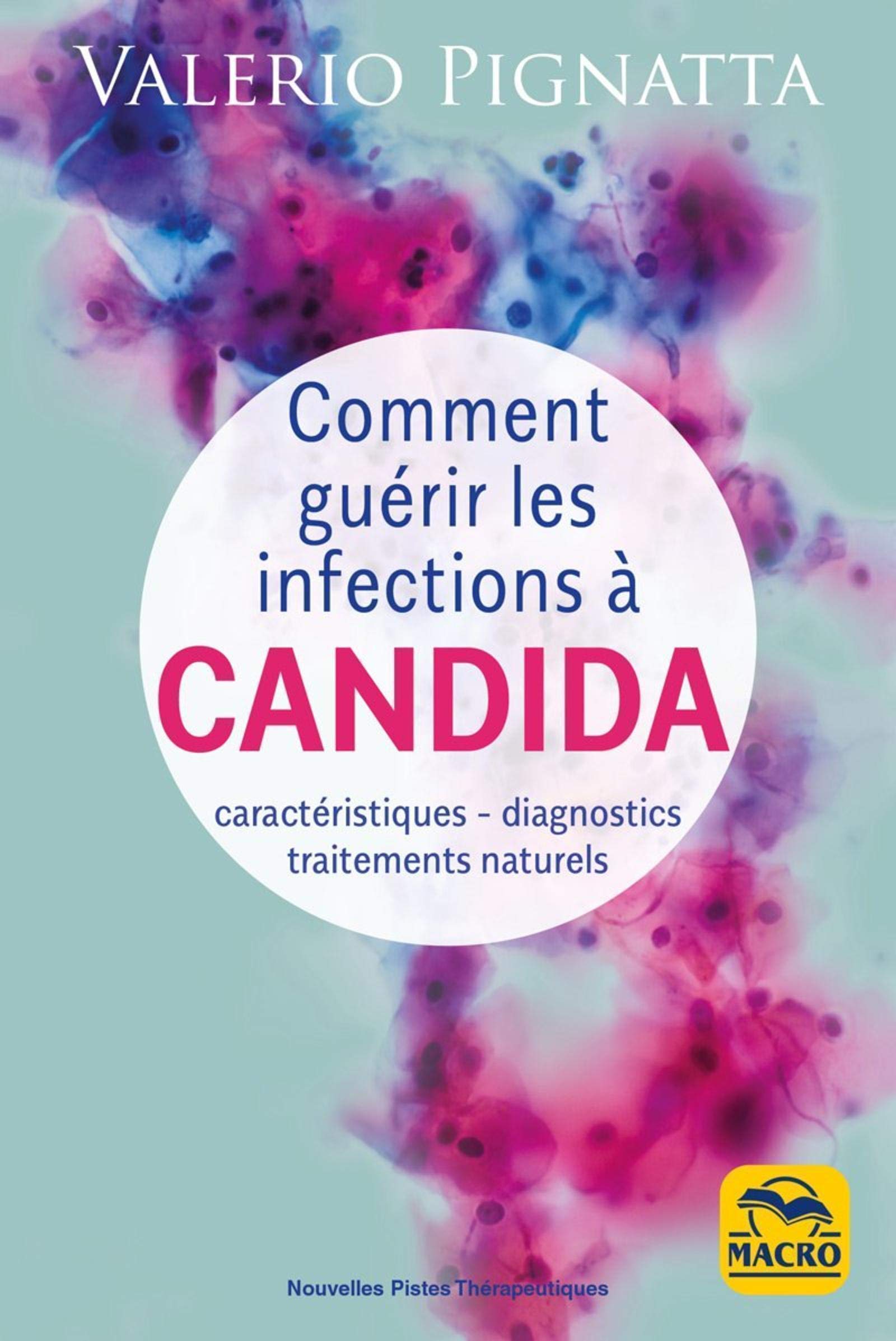Comment guérir les infections à Candida: Caractéristiques - diagnostics - traitements naturels Health, Nutrition & Fitness