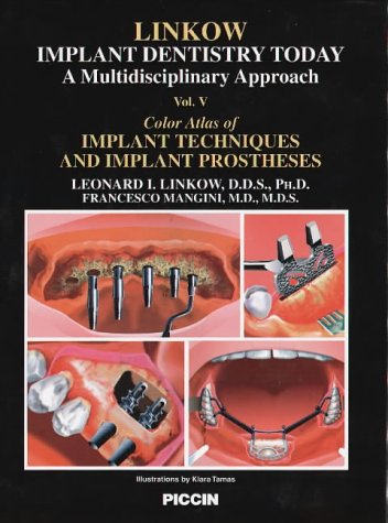 Color Atlas of Implant Techniques and Implant Prostheses Medicine