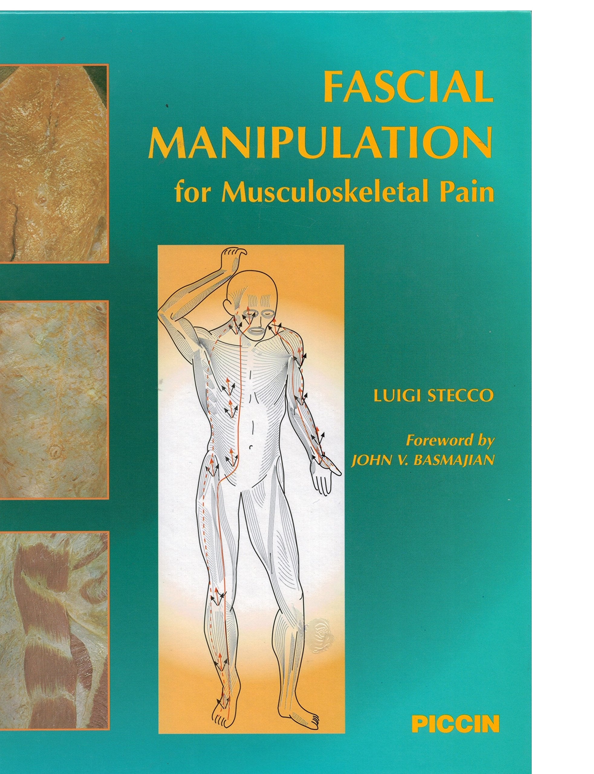 Fascial Manipulation for Musculoskeletal Pain Medicine