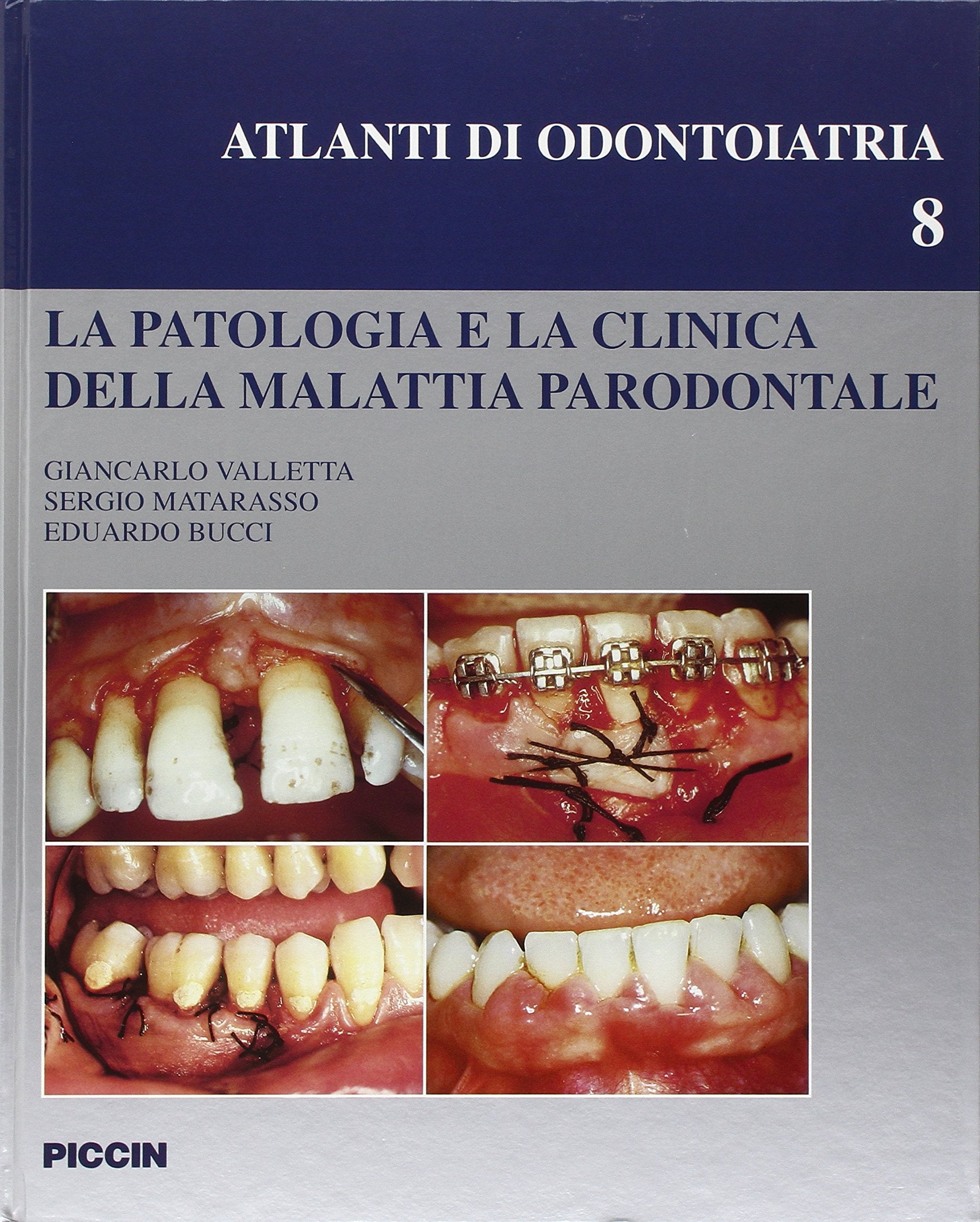 La patologia e la clinica della malattia parodontale Medicine