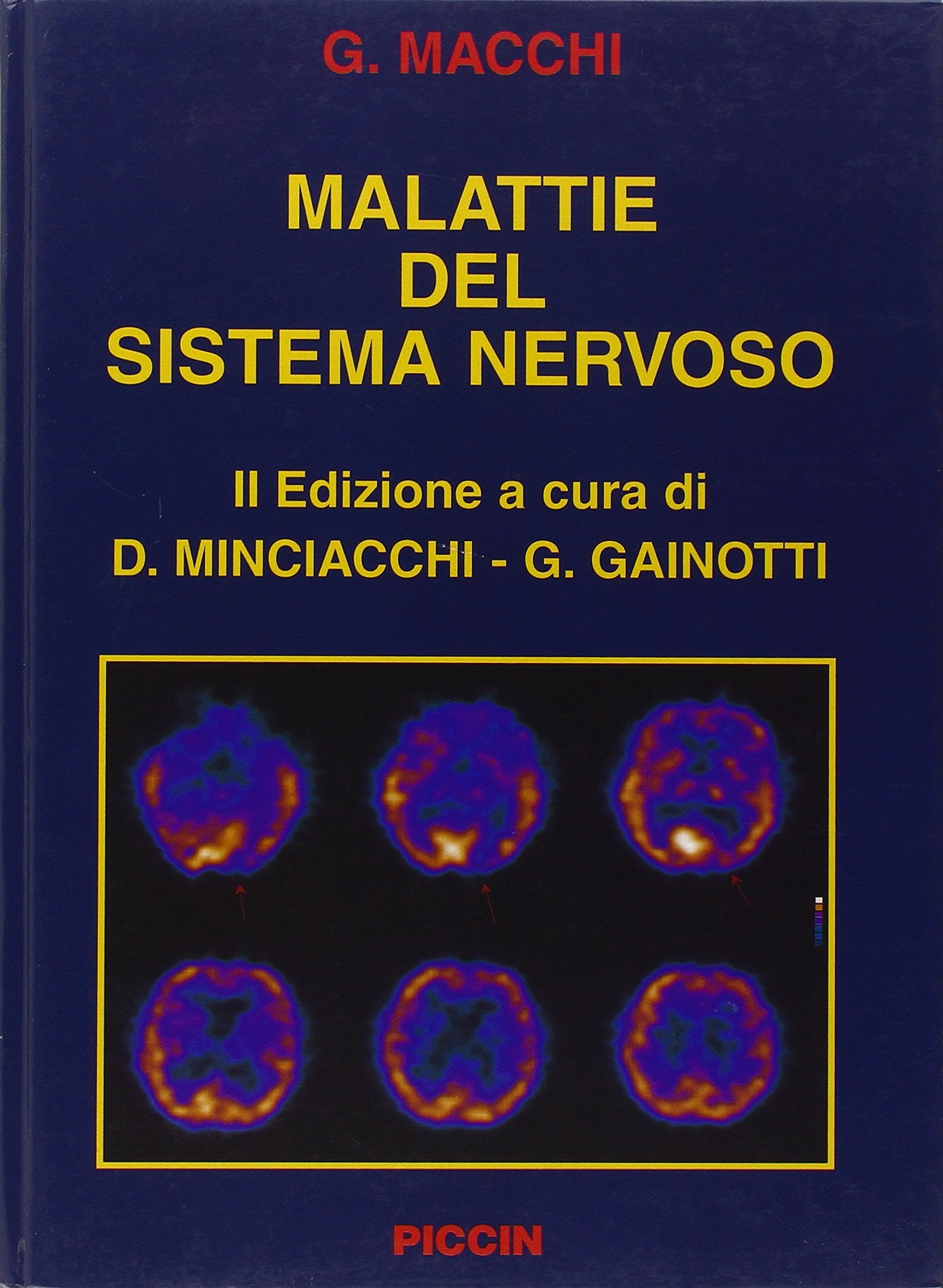 Malattie del sistema nervoso Medicine