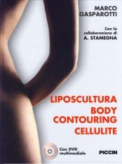 Liposcultura body contouring cellulite. Con DVD Medicine
