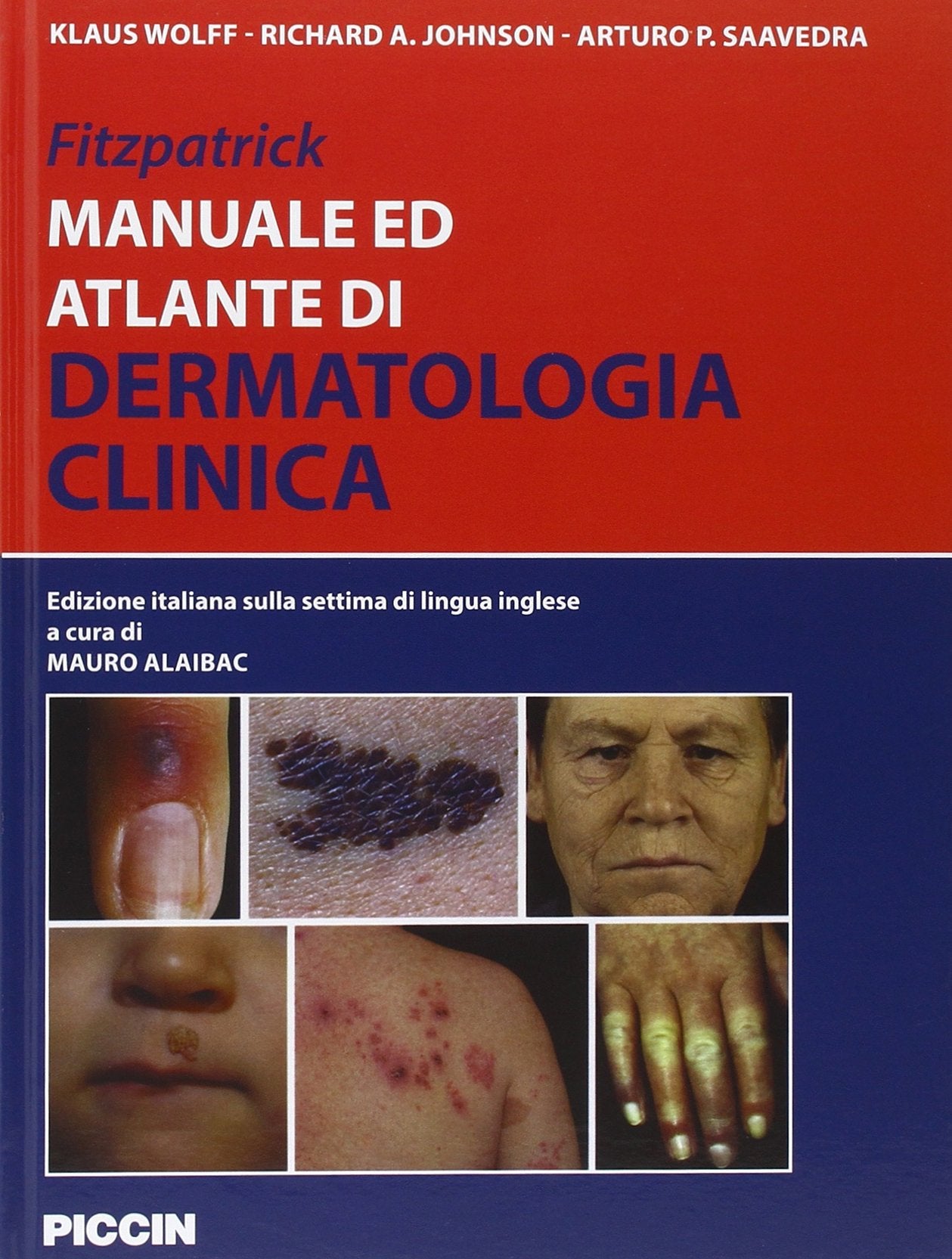 Fitzpatrick. Manuale ed atlante di dermatologia clinica Medicine