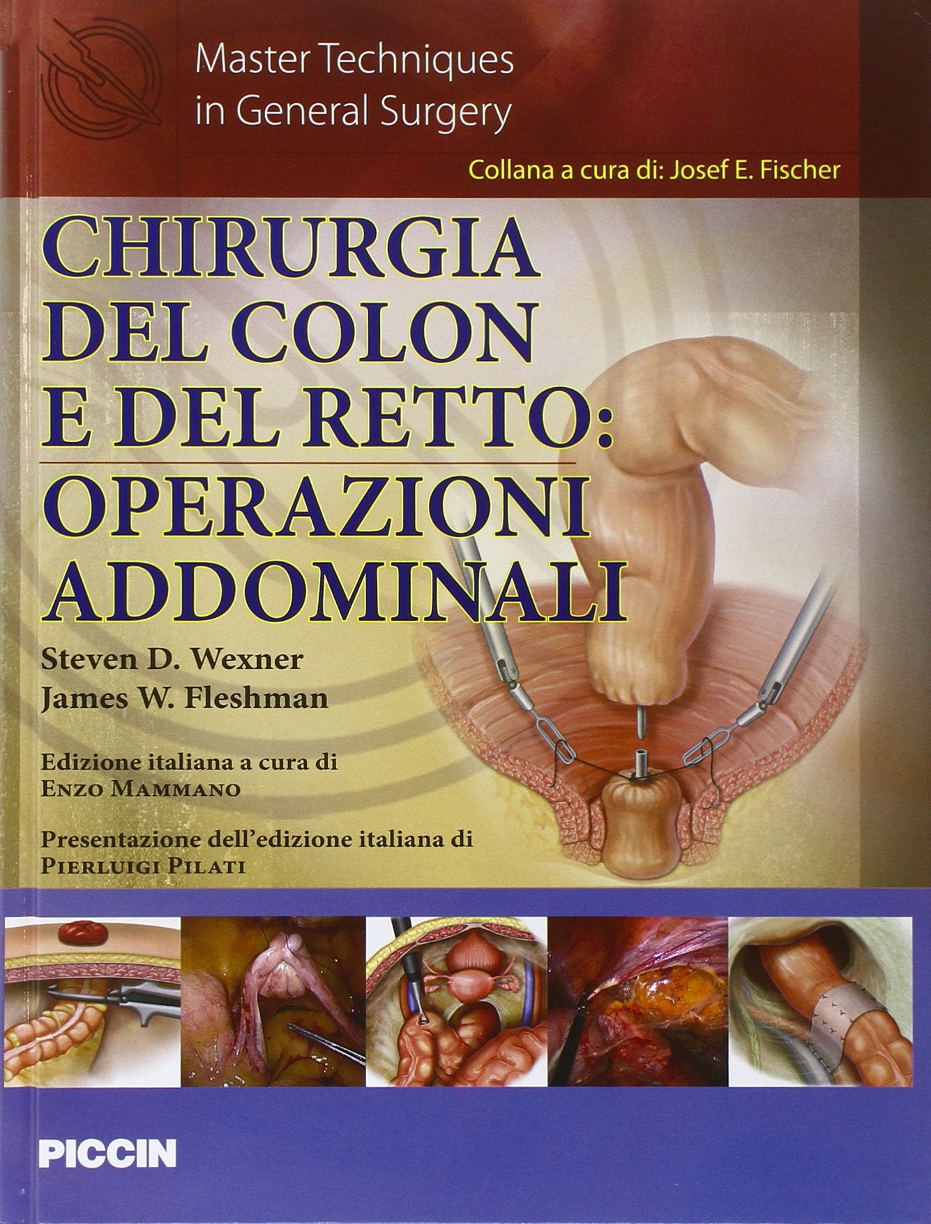 Chirurgia del colon e del retto. Operazioni addominali Medicine
