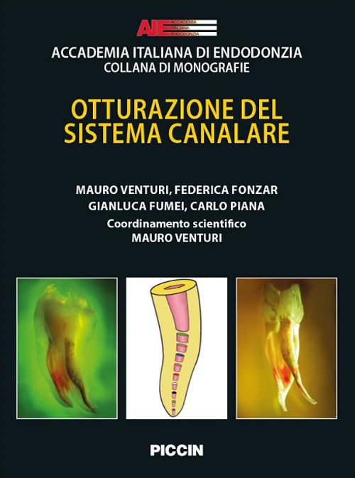 Otturazione del sistema canalare book