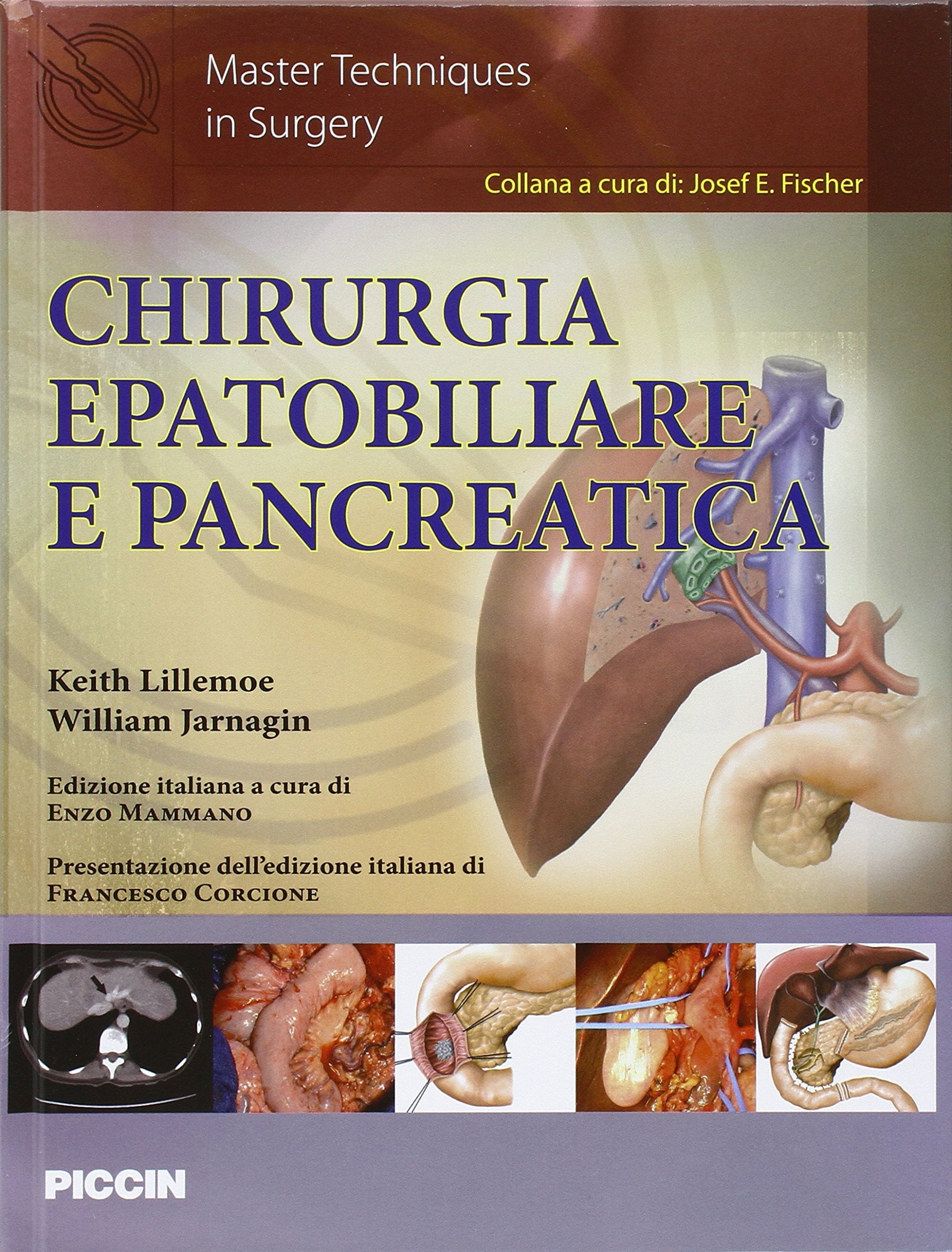 Chirurgia epatobiliare e pancreatica Medicine