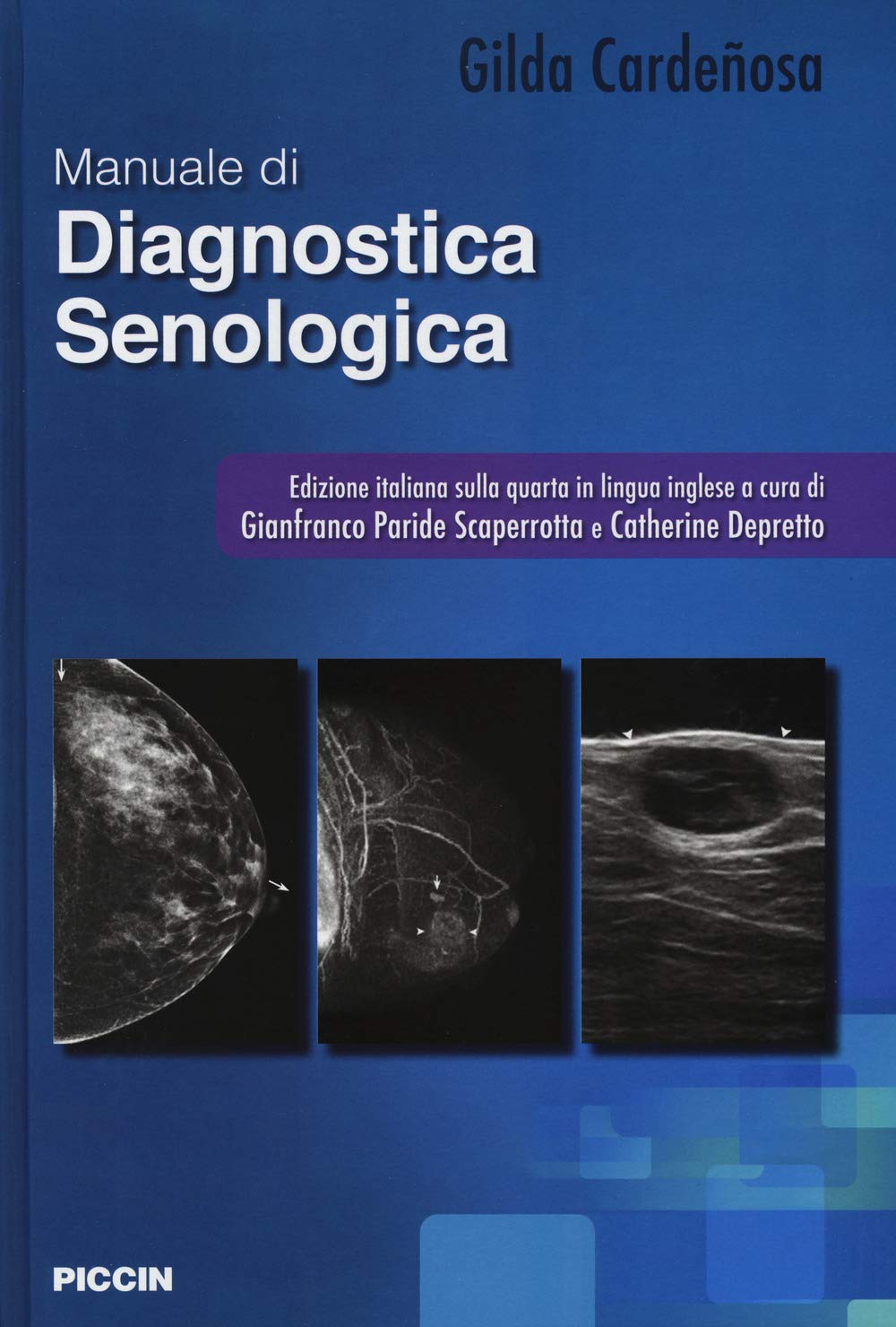 Manuale di diagnostica senologica book