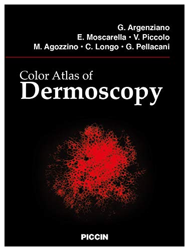 Color Atlas of Dermoscopy Medicine