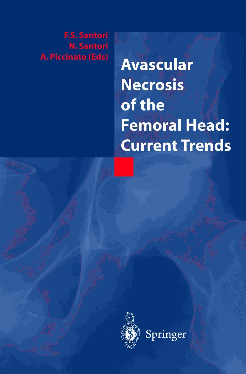 Avascular Necrosis of the Femoral Head: Current Trends Medicine