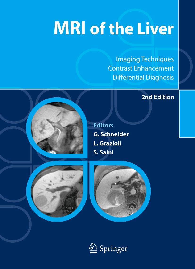 MRI of the Liver: Imaging Techniques, Contrast Enhancement, Differential Diagnosis Medicine