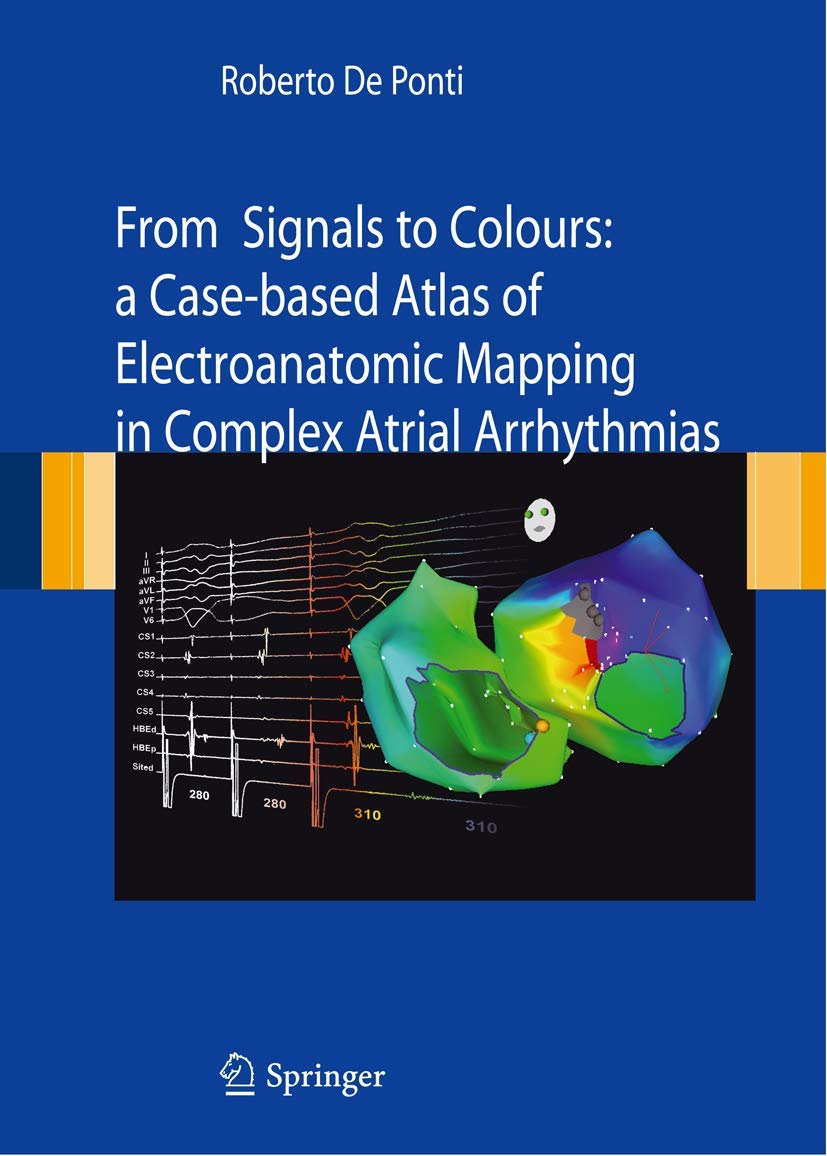 Riabilitazione: dall'inquadramento clinico al trattamento riabilitativo: Raccolta di articoli pubblicati sulla Testata registrata “Medici Oggi”: A ... Mapping in Complex Atrial arrhythmias Medicine
