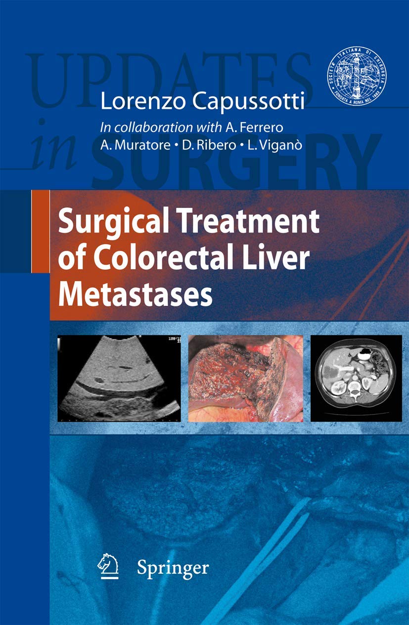 Surgical Treatment of Colorectal Liver Metastases Medicine