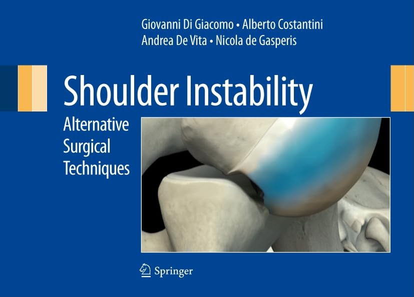 Product Image: Shoulder Instability