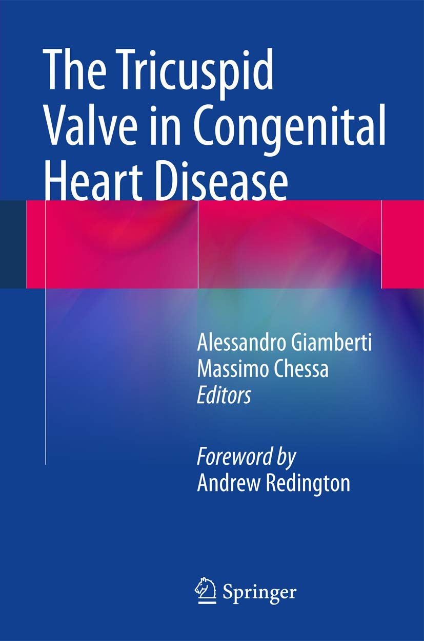 The Tricuspid Valve in Congenital Heart Disease book
