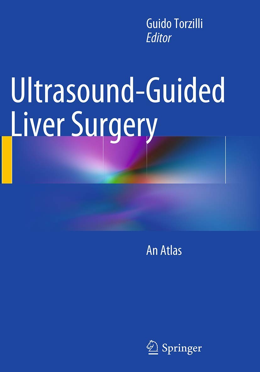 Ultrasound-Guided Liver Surgery: An Atlas book