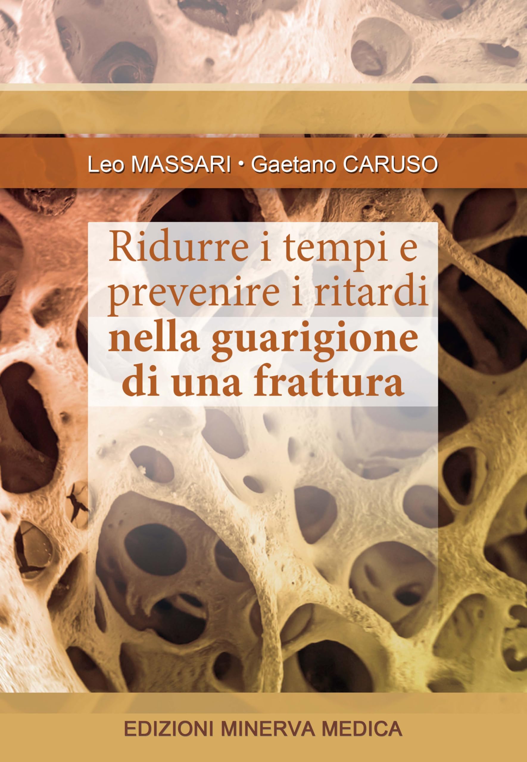 Ridurre i tempi e prevenire i ritardi nella guarigione di una frattura book