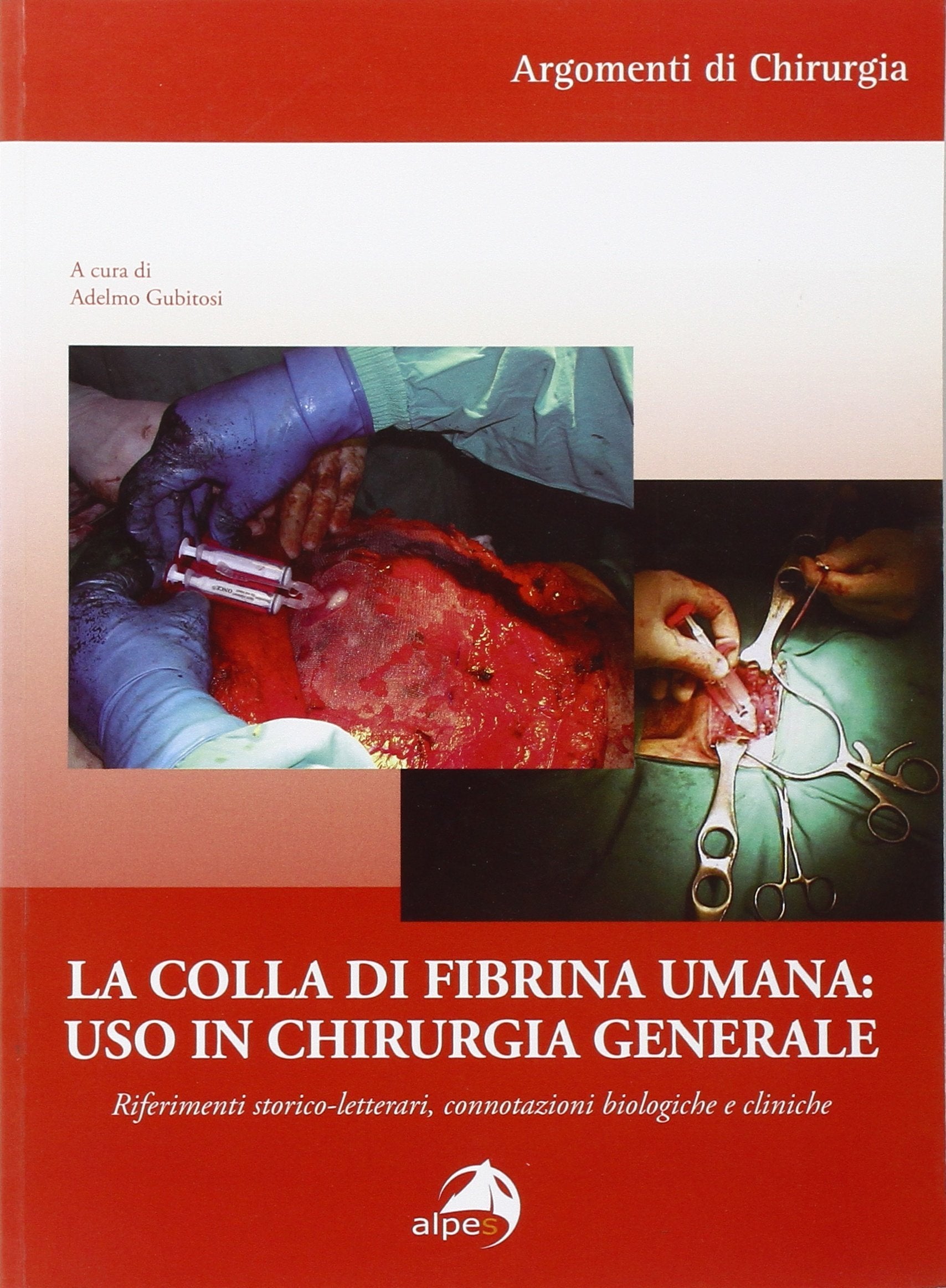 La colla di fibrina umana. Uso in chirurgia generale. Riferimenti storico-letterari, connotazioni biologiche e cliniche (Argomenti di chirurgia) Medicine