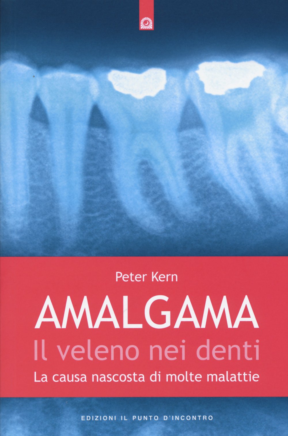 Amalgama. Il veleno nei denti. La causa nascosta di molte malattie (Salute e benessere) Medicine