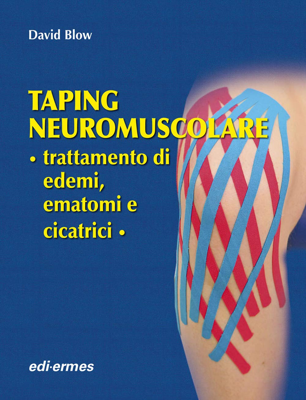 Taping neuromuscolare. Trattamento di edemi, ematomi e cicatrici Medicine