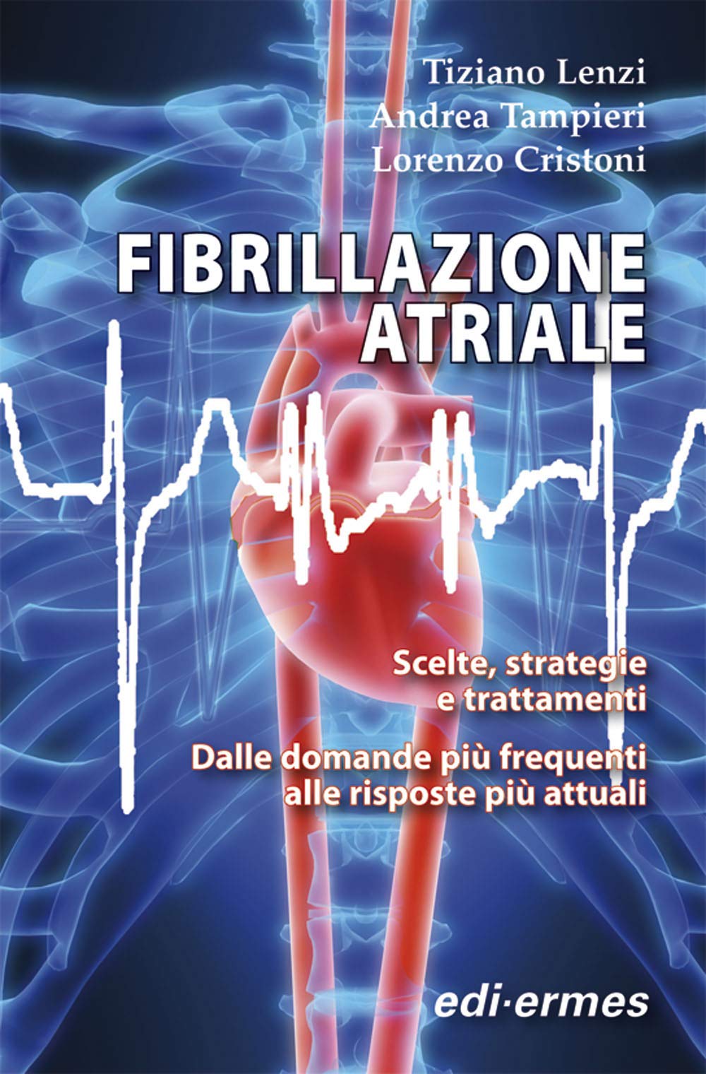 Fibrillazione atriale. Scelte, strategie e trattamenti. Dalle domande più frequenti alle risposte più attuali Medicine