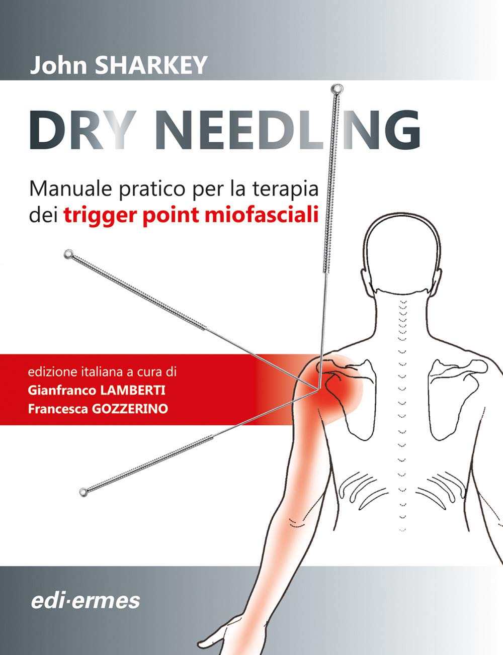 Dry Needling. Manuale pratico per la terapia dei trigger point miofasciali Medicine