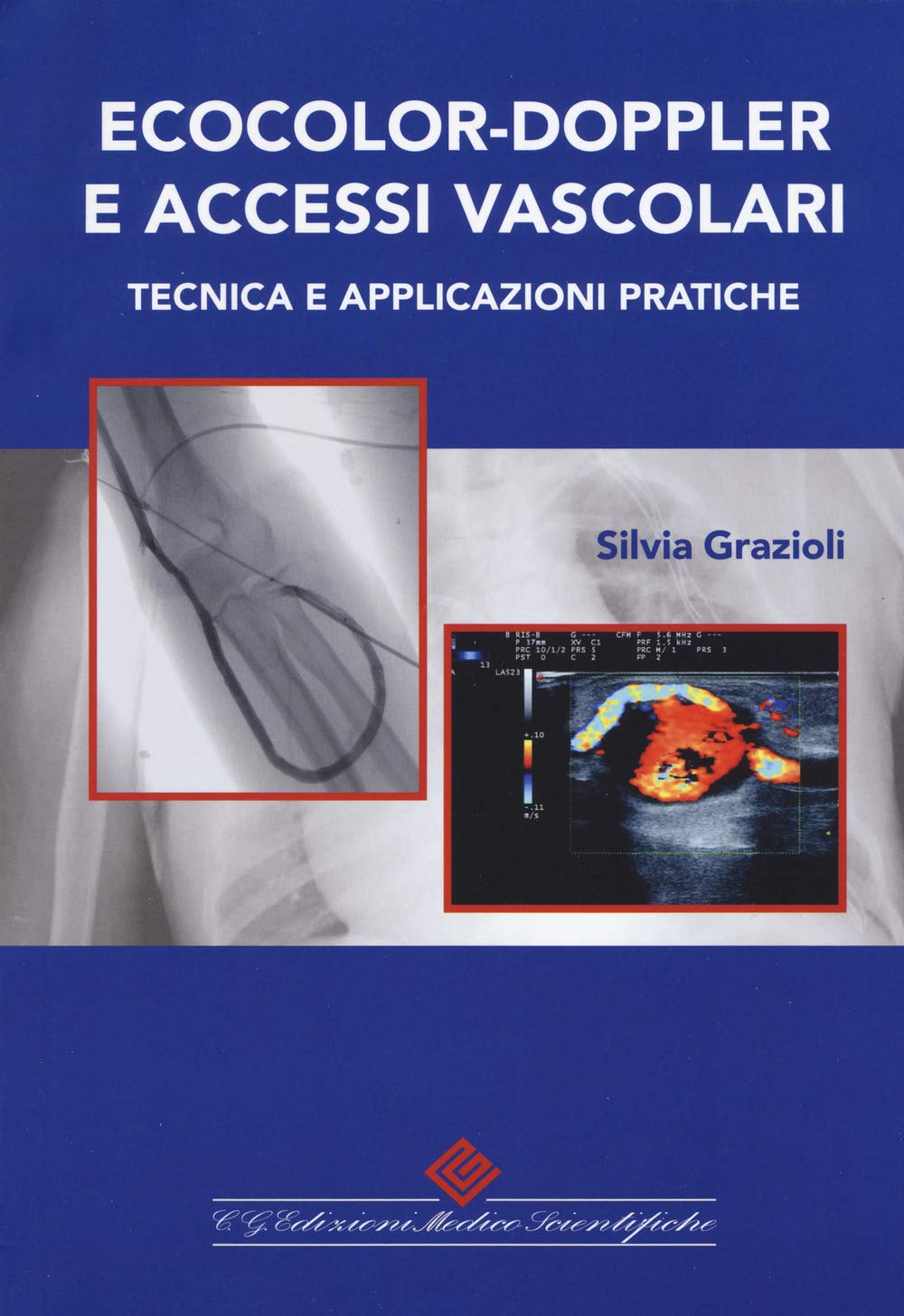 Ecocolor-doppler e accessi vascolari. Tecnica e applicazioni pratiche book