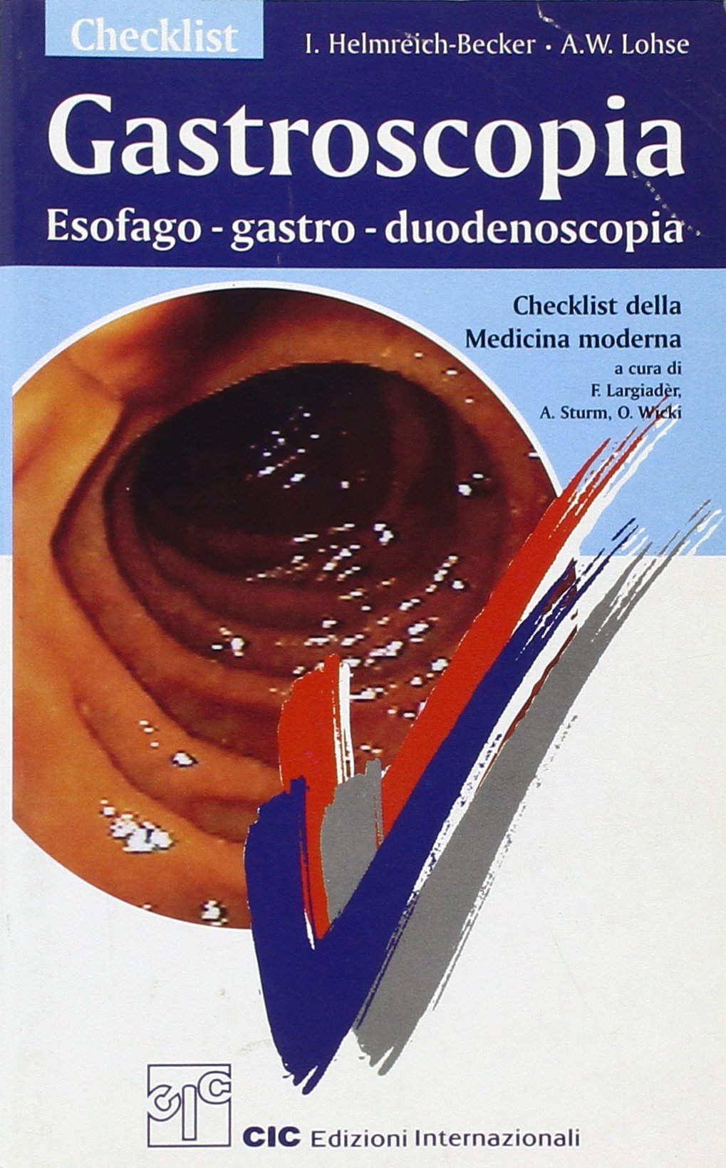 Checklist gastroscopia. Esofago-gastro-duodenoscopia (Checklist della medicina moderna) Medicine