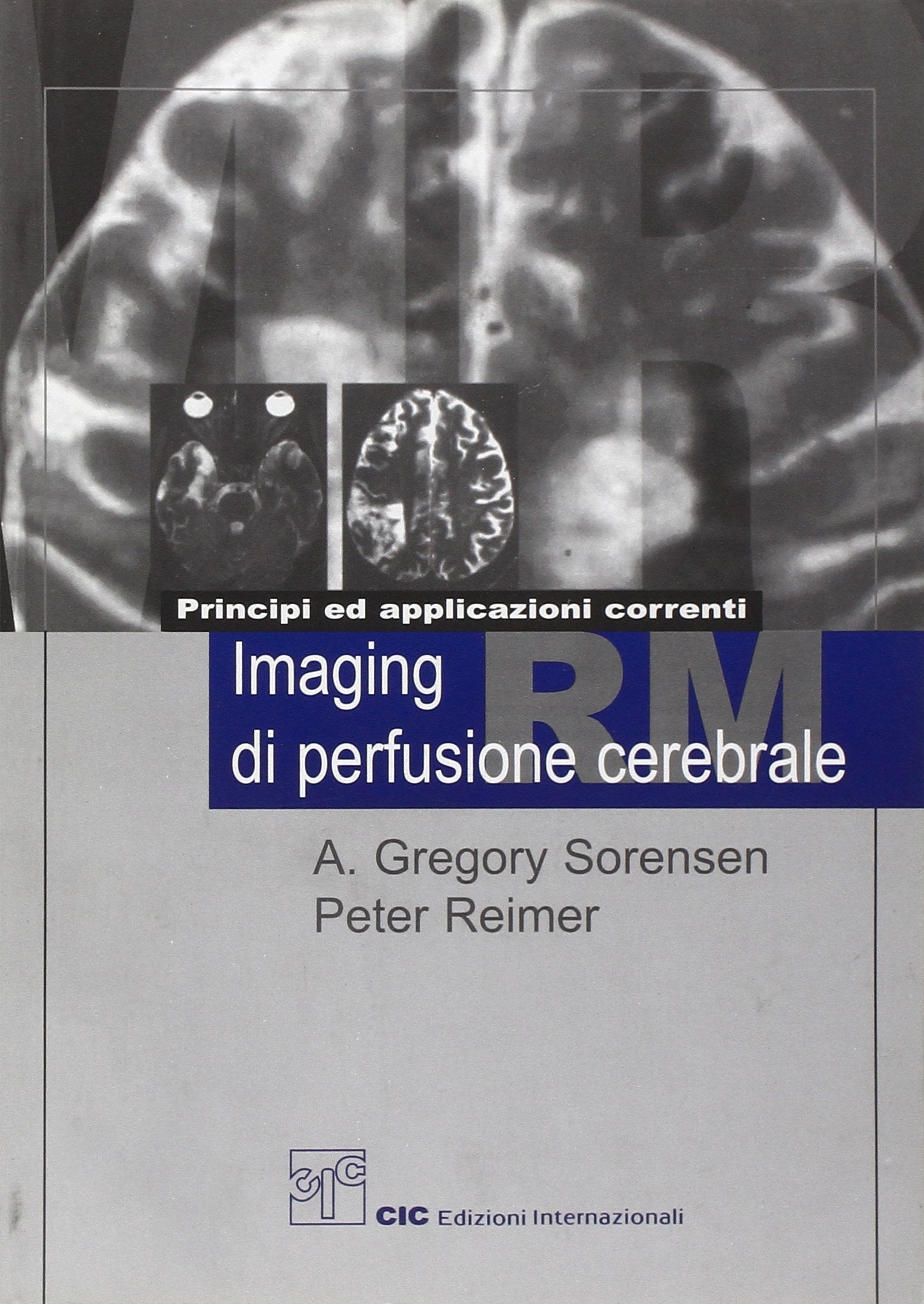 Principi ed applicazioni correnti. Imaging RM di perfusione cerebrale Medicine