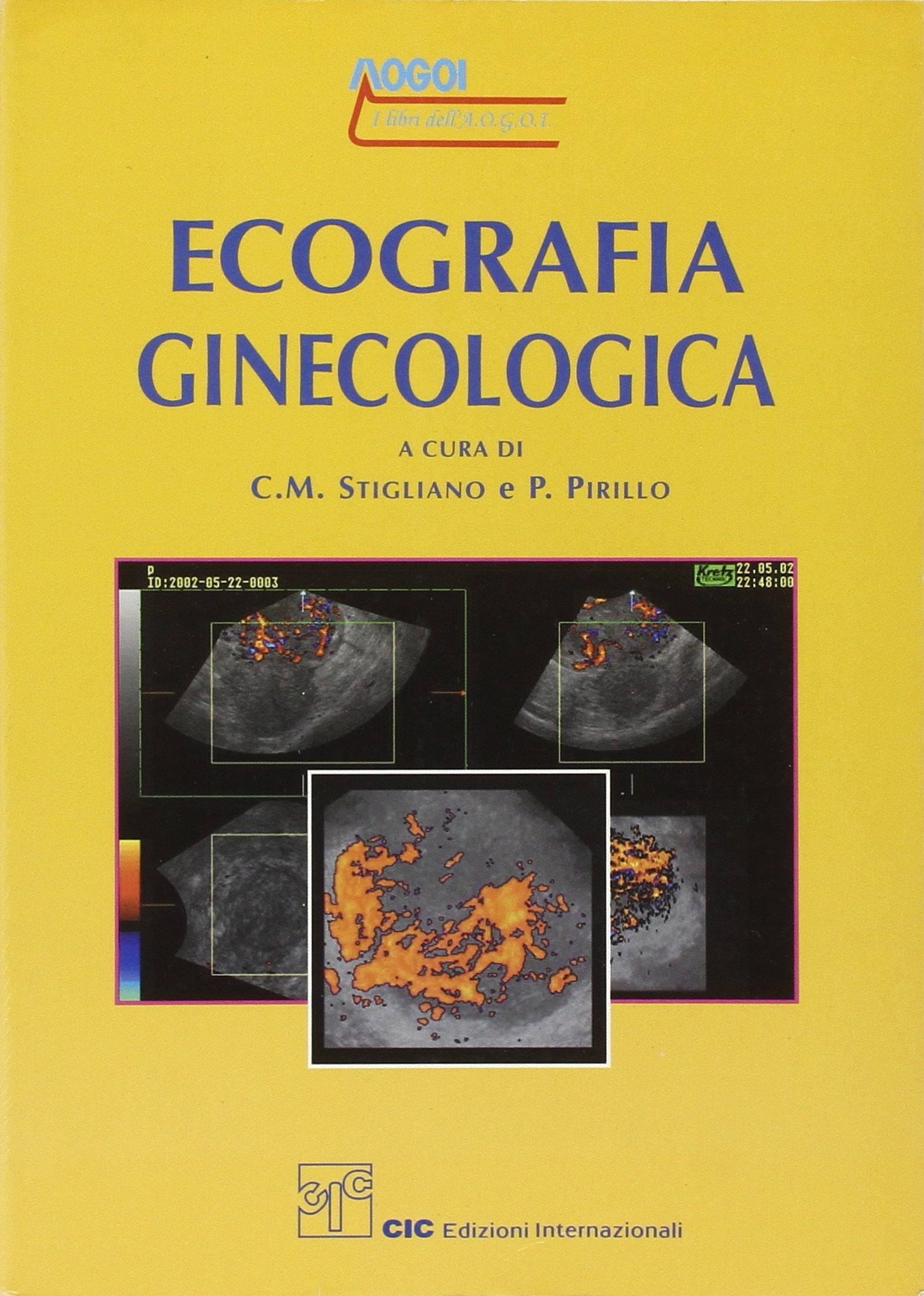 Ecografia ginecologica Medicine