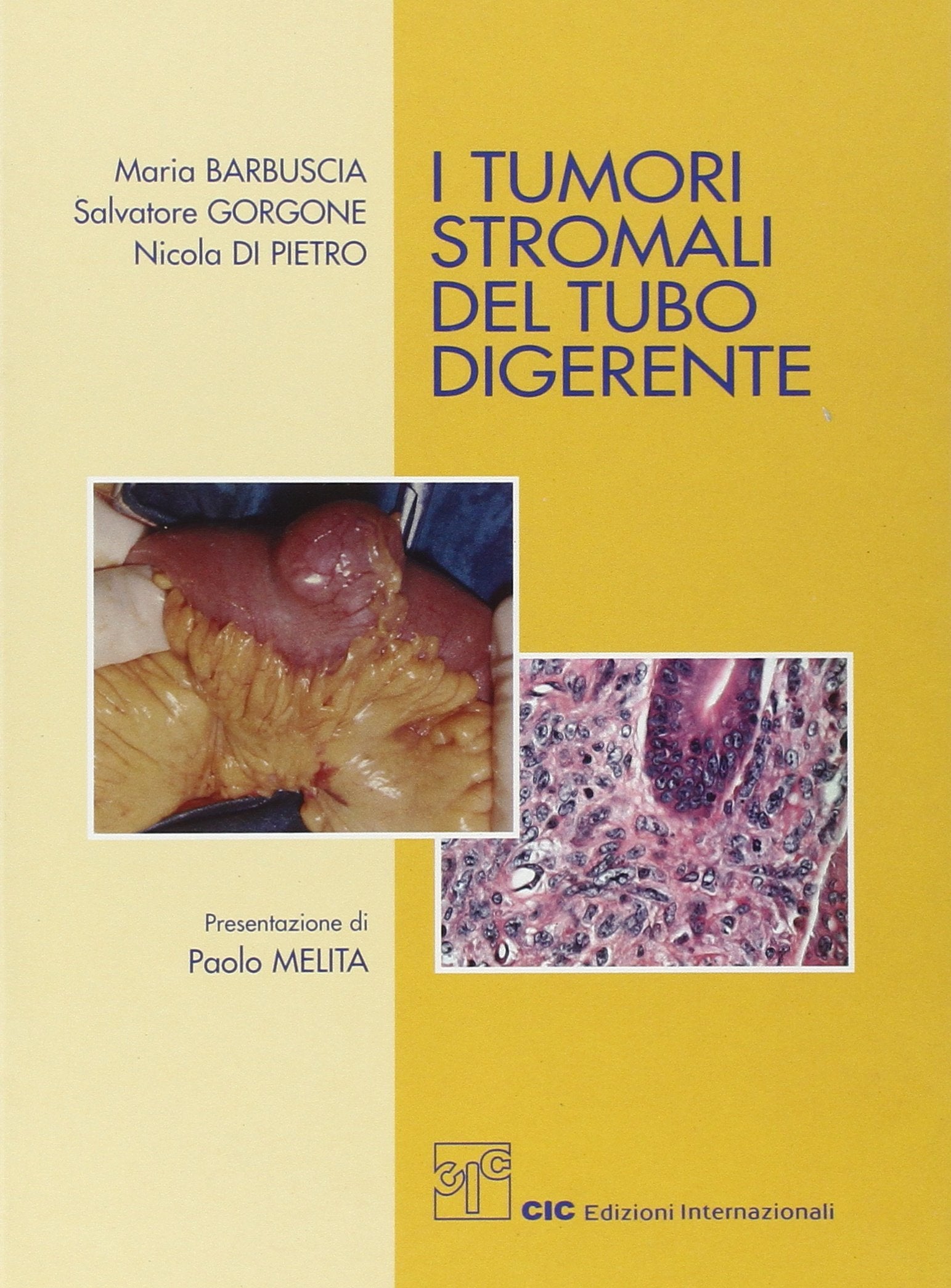 I tumori stronali del tubo digerente Medicine