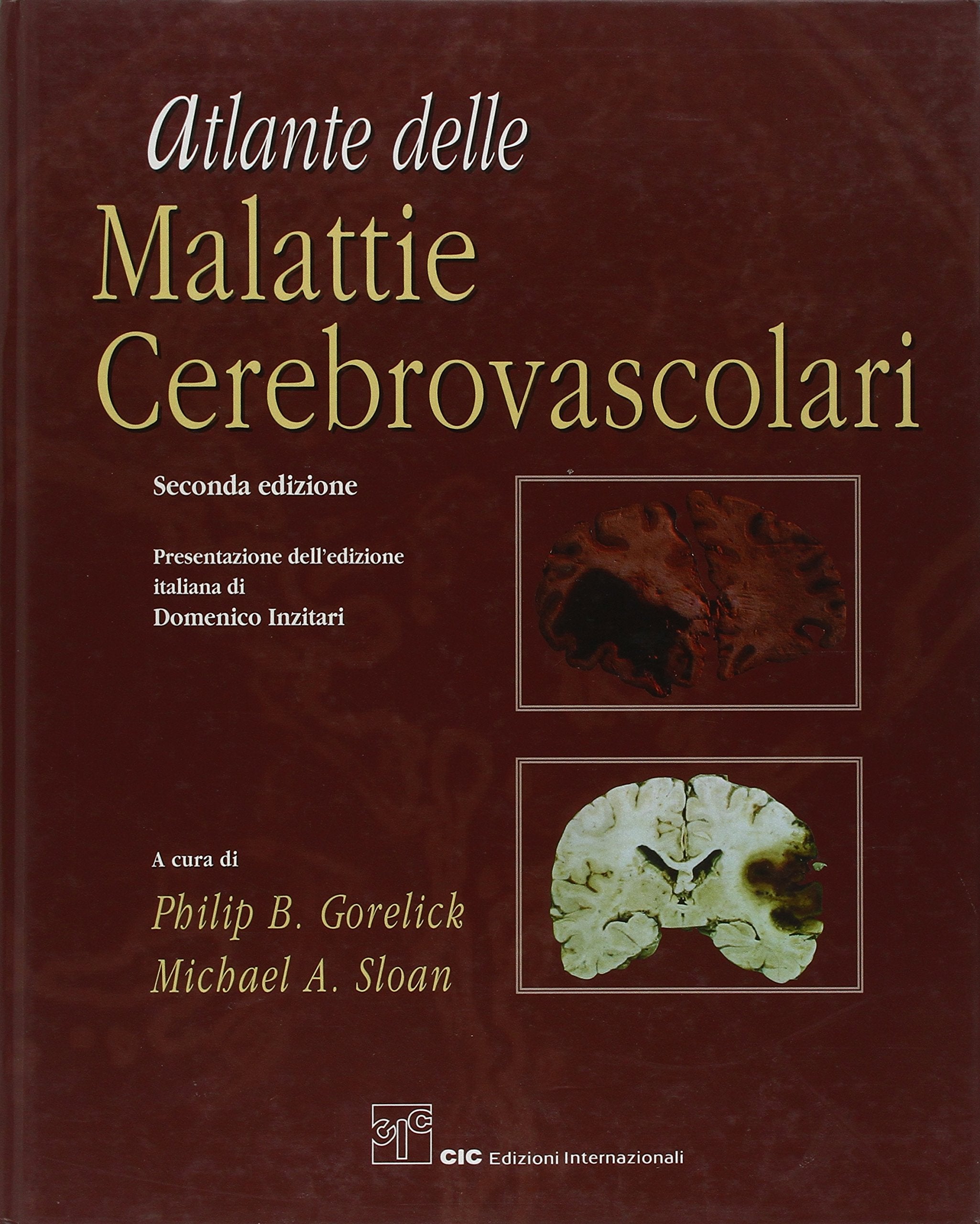 Atlante delle malattie cerebrovascolari Medicine