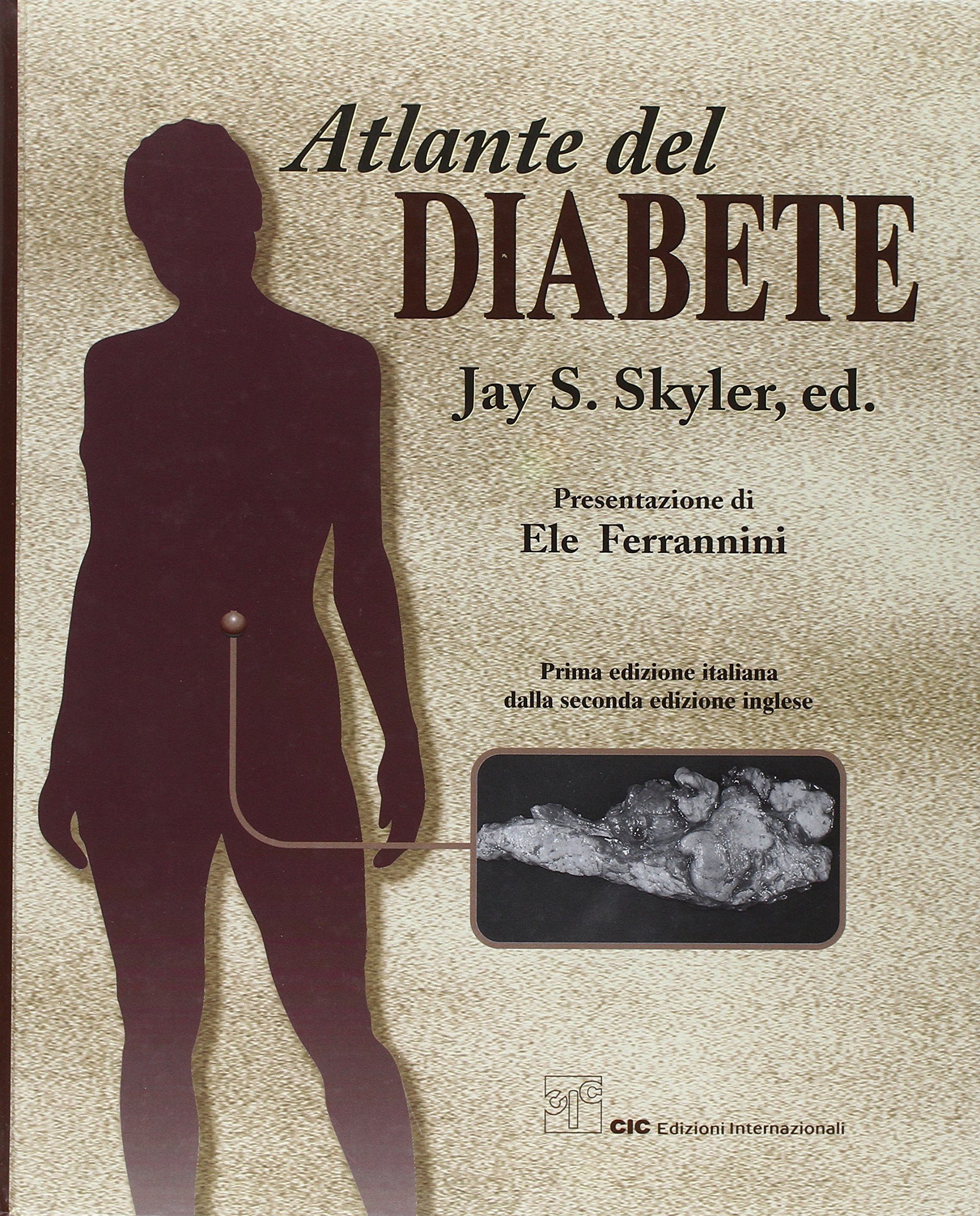 Atlante del diabete Medicine