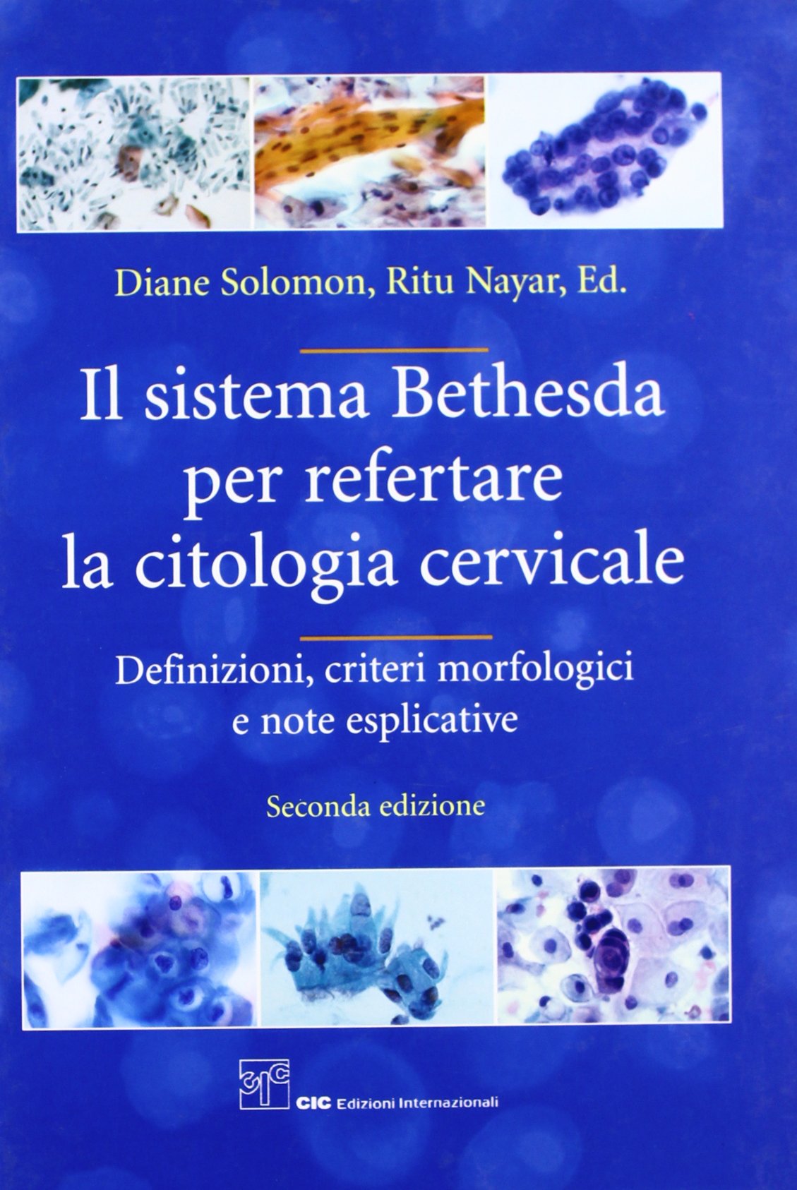 Il sistema Bethesda per repertare la citologia verticale. Definizioni, criteri morfologici e note esplicative Medicine